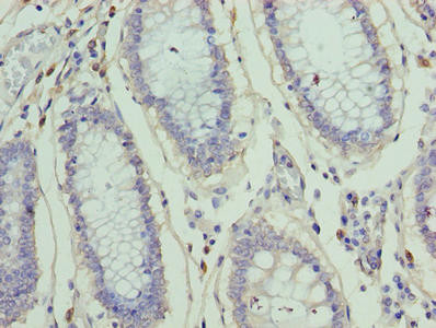 ZNF555 Antibody in Immunohistochemistry (Paraffin) (IHC (P))