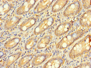 ZNF562 Antibody in Immunohistochemistry (Paraffin) (IHC (P))