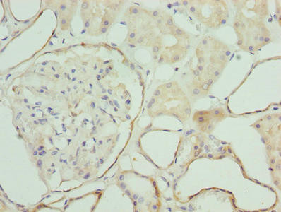 ZNF563 Antibody in Immunohistochemistry (Paraffin) (IHC (P))