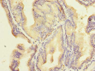 ZNF614 Antibody in Immunohistochemistry (Paraffin) (IHC (P))