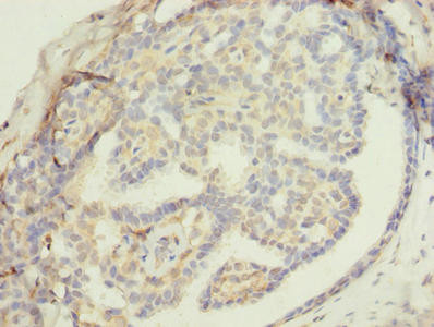 ZNF626 Antibody in Immunohistochemistry (Paraffin) (IHC (P))