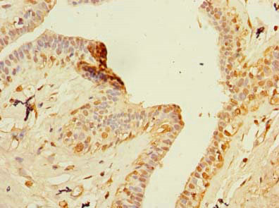 ZNF670 Antibody in Immunohistochemistry (Paraffin) (IHC (P))