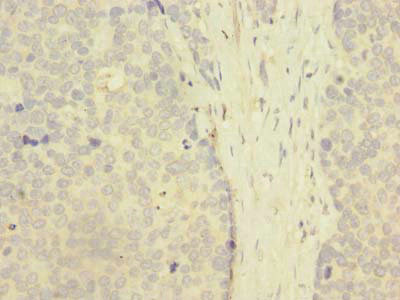 ZNF707 Antibody in Immunohistochemistry (Paraffin) (IHC (P))