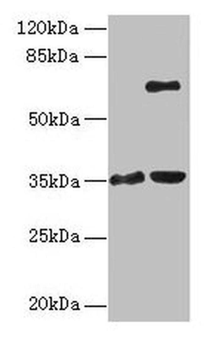 ZNF75A Antibody in Western Blot (WB)