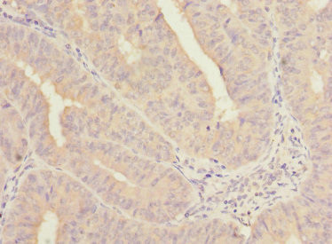 COBRA1 Antibody in Immunohistochemistry (Paraffin) (IHC (P))