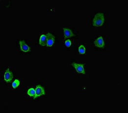 TUBA1B Antibody in Immunocytochemistry (ICC/IF)