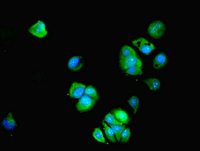 BTBD2 Antibody in Immunocytochemistry (ICC/IF)