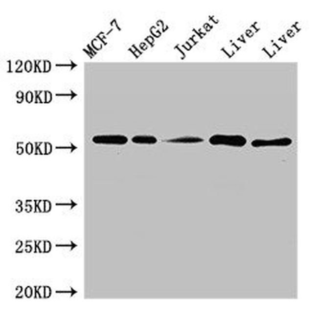 MYST1 Antibody in Western Blot (WB)