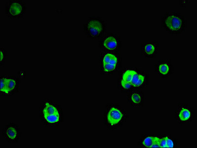 SRGAP2B Antibody in Immunocytochemistry (ICC/IF)