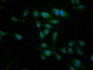 NT5C2 Antibody in Immunocytochemistry (ICC/IF)