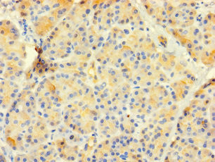 CTRB1 Antibody in Immunohistochemistry (Paraffin) (IHC (P))