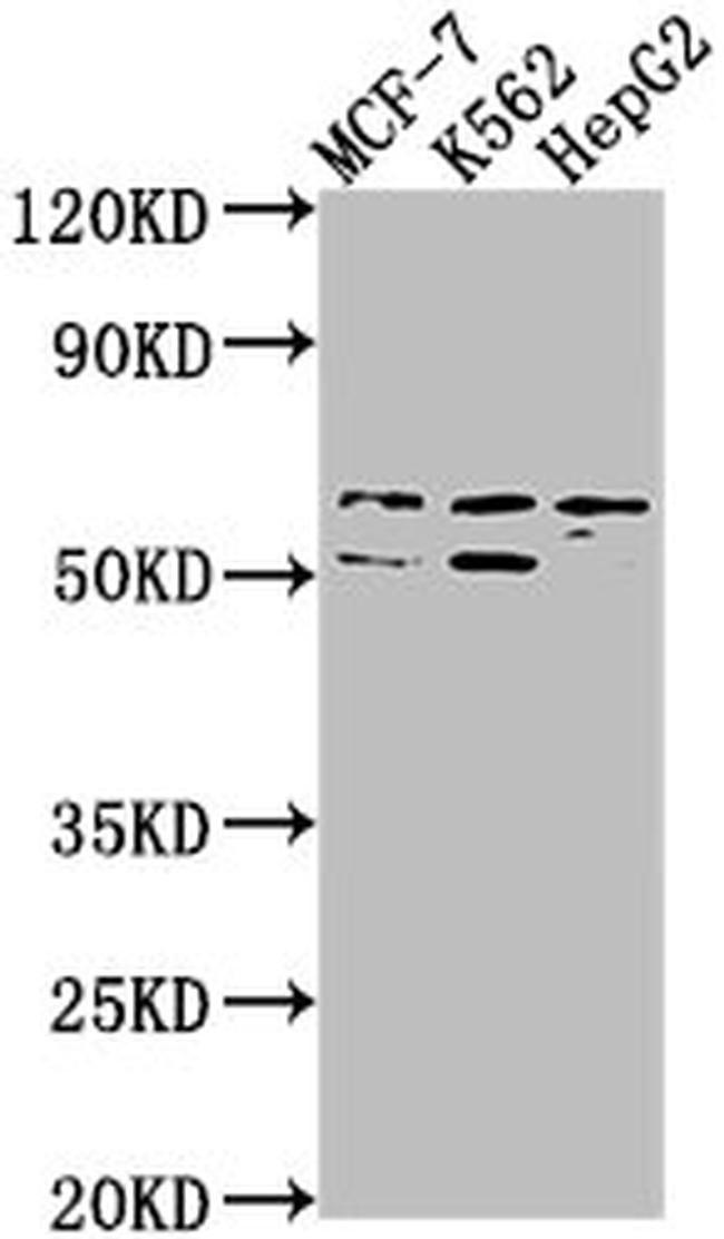 USP17L3 Antibody in Western Blot (WB)