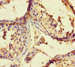 ARHGAP42 Antibody in Immunohistochemistry (Paraffin) (IHC (P))