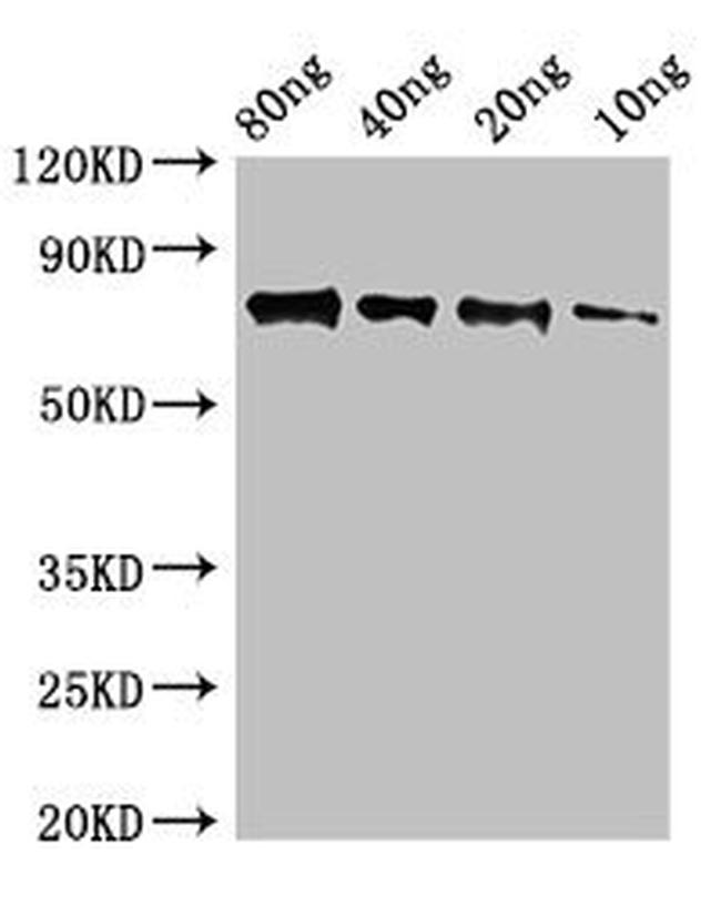 SAP9 Antibody in Western Blot (WB)