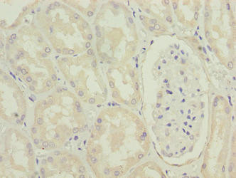 MRPL49 Antibody in Immunohistochemistry (Paraffin) (IHC (P))