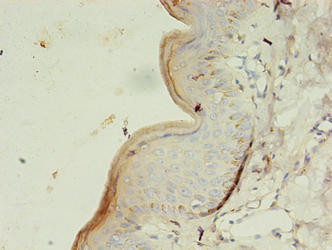 Glycerol kinase 3 Antibody in Immunohistochemistry (Paraffin) (IHC (P))