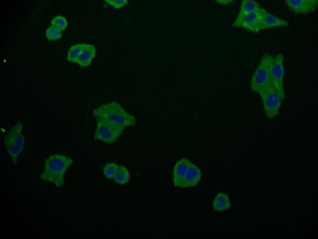 AMHR2 Antibody in Immunocytochemistry (ICC/IF)