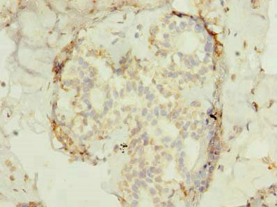 FAM53B Antibody in Immunohistochemistry (Paraffin) (IHC (P))