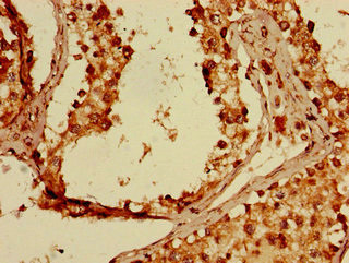 FKBP8 Antibody in Immunohistochemistry (Paraffin) (IHC (P))