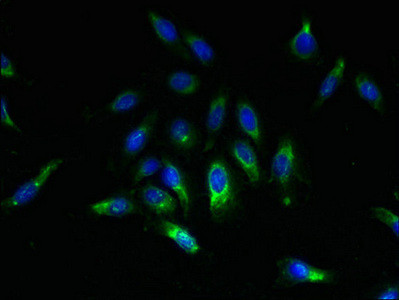 SPCS2 Antibody in Immunocytochemistry (ICC/IF)