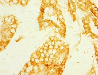 MEP1B Antibody in Immunohistochemistry (Paraffin) (IHC (P))