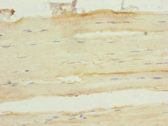 FHL3 Antibody in Immunohistochemistry (Paraffin) (IHC (P))