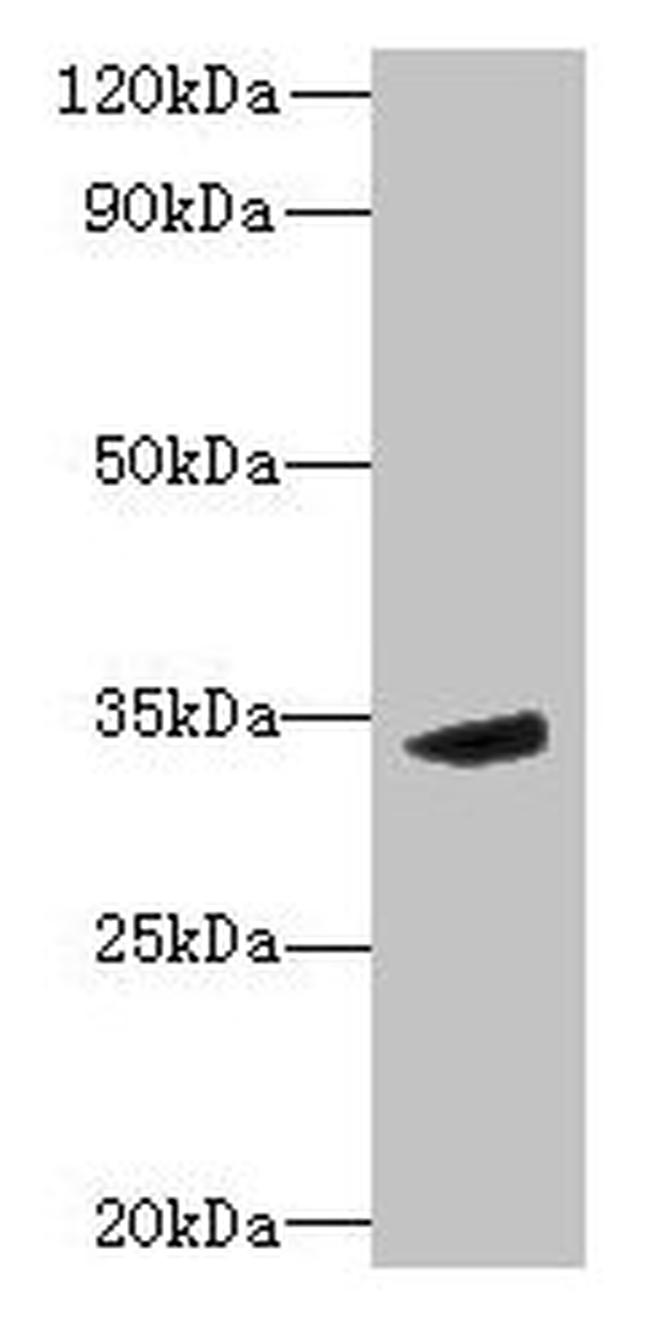 MPPED2 Antibody in Western Blot (WB)