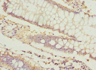 ICAM-4 Antibody in Immunohistochemistry (Paraffin) (IHC (P))