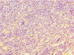 CHI3L2 Antibody in Immunohistochemistry (Paraffin) (IHC (P))