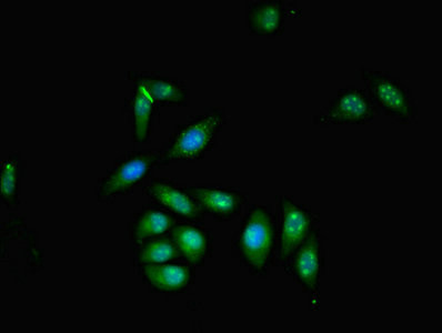 ZMYND11 Antibody in Immunocytochemistry (ICC/IF)