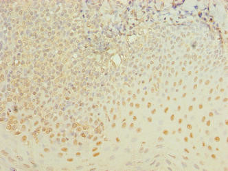 ZBTB6 Antibody in Immunohistochemistry (Paraffin) (IHC (P))