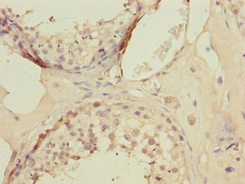 KLF9 Antibody in Immunohistochemistry (Paraffin) (IHC (P))