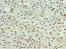 COTL1 Antibody in Immunohistochemistry (Paraffin) (IHC (P))