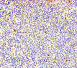 COTL1 Antibody in Immunohistochemistry (Paraffin) (IHC (P))