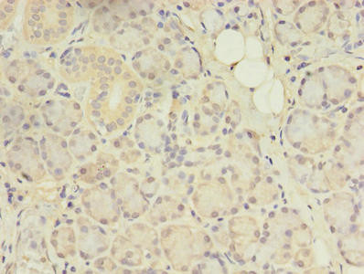 CENTB1 Antibody in Immunohistochemistry (Paraffin) (IHC (P))