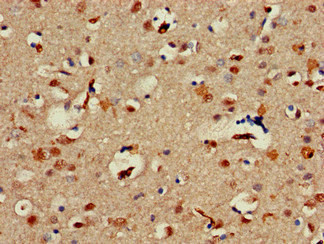ALX1 Antibody in Immunohistochemistry (Paraffin) (IHC (P))