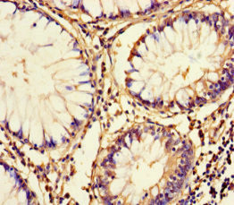 FAM161A Antibody in Immunohistochemistry (Paraffin) (IHC (P))