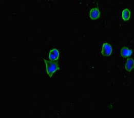 CERKL Antibody in Immunocytochemistry (ICC/IF)