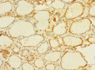 C8orf34 Antibody in Immunohistochemistry (Paraffin) (IHC (P))