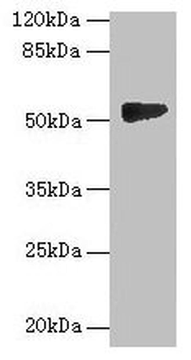GTDC1 Antibody in Western Blot (WB)