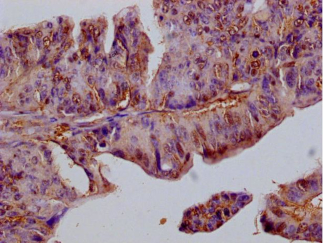 FILIP1L Antibody in Immunohistochemistry (Paraffin) (IHC (P))