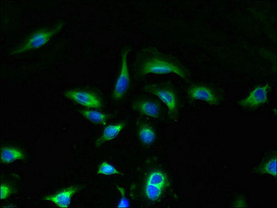 UNC50 Antibody in Immunocytochemistry (ICC/IF)