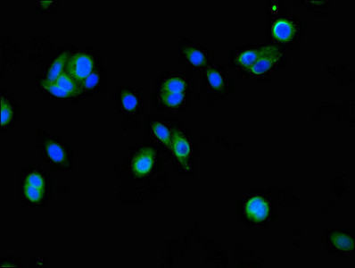 FSIP2 Antibody in Immunocytochemistry (ICC/IF)