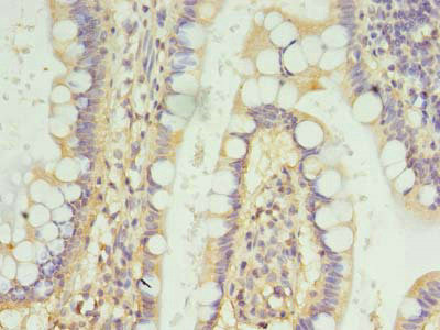 FSCB Antibody in Immunohistochemistry (Paraffin) (IHC (P))