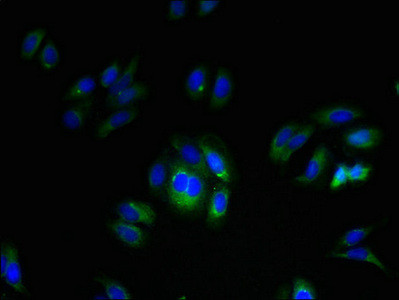 TMEM255A Antibody in Immunocytochemistry (ICC/IF)
