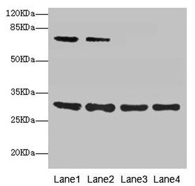 SPIN3 Antibody in Western Blot (WB)