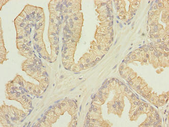 FAM78A Antibody in Immunohistochemistry (Paraffin) (IHC (P))