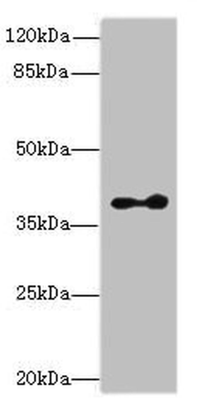 CLVS2 Antibody in Western Blot (WB)