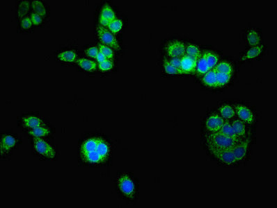 ATAD3B Antibody in Immunocytochemistry (ICC/IF)