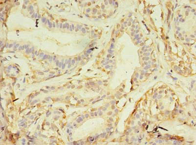 NAIF1 Antibody in Immunohistochemistry (Paraffin) (IHC (P))